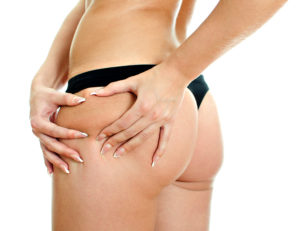 Young woman folding skin on her hips with both hands.Close up view. Isolated on white